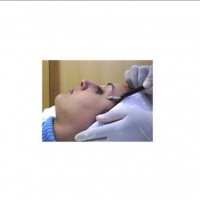 Lifting facial