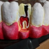 arte para faculdade de odontologia AL.